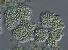 Nzev:		Microcystis viridis	
Zvteno:	400 x
Technika:	Nomarskho kontrast
Datum:		2004-07-01
Lokalita: 	Hracholusky u Plzn
